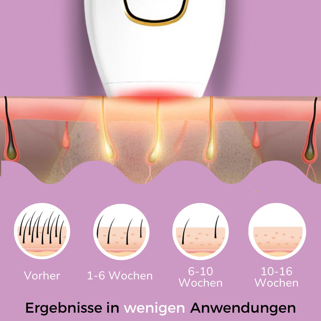 Ylvis IPL™ - Haarentferner